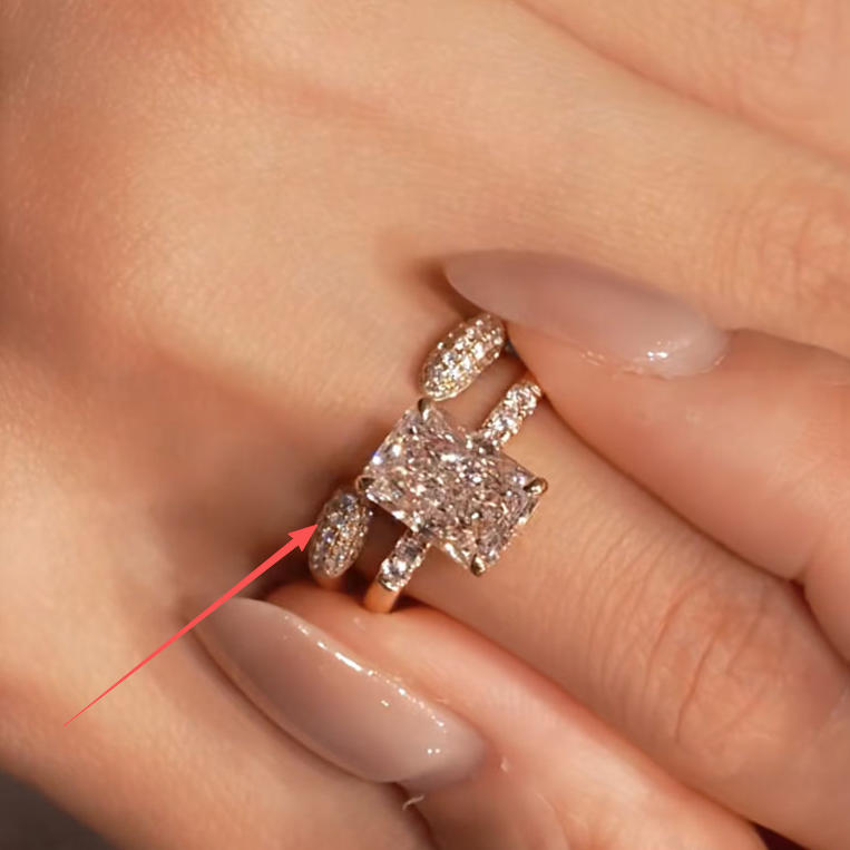 Versatile Ring